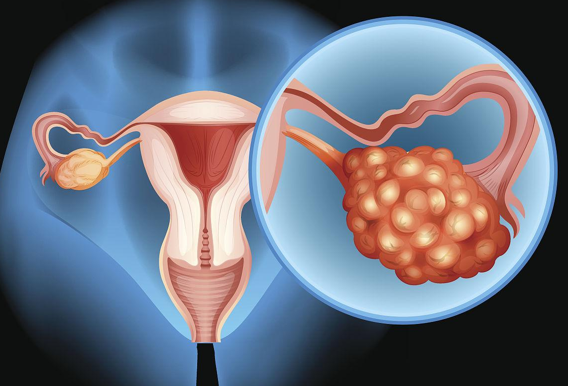 助孕是真的假的啊,如何调理卵巢早衰助孕？