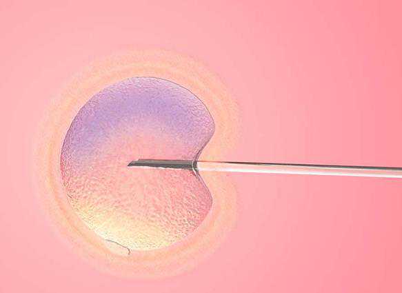 多囊卵巢综合征有哪些治疗方法